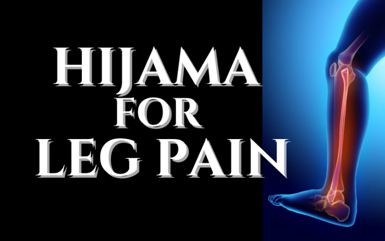 Cupping Hijama For LEG PAIN NUMBNESS Hijama Cupping 