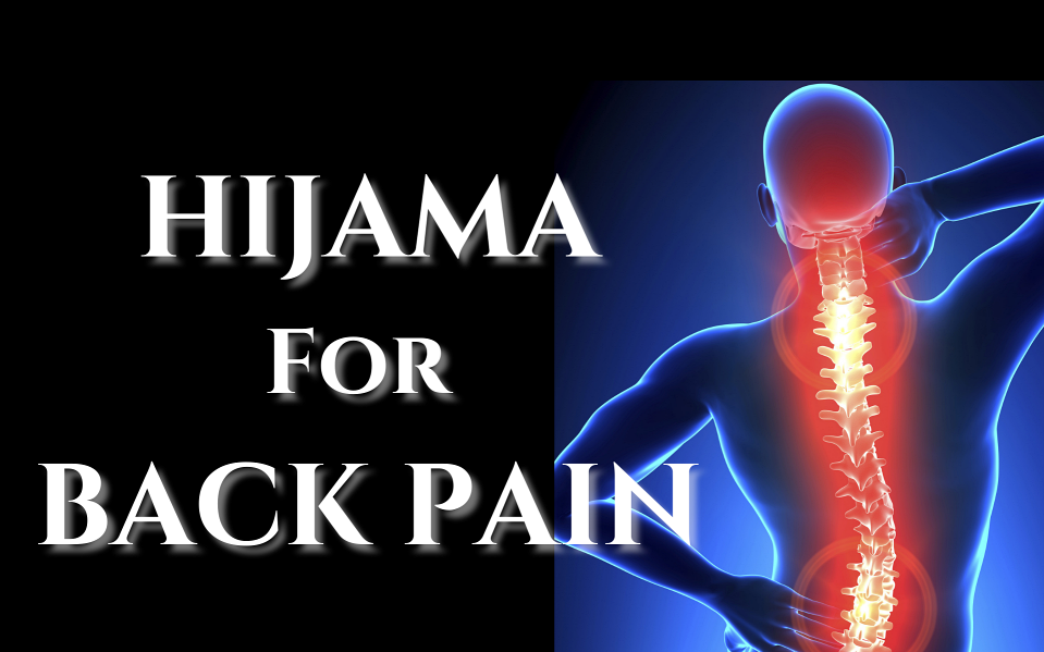 You are currently viewing Cupping (Hijama) for BACK PAIN