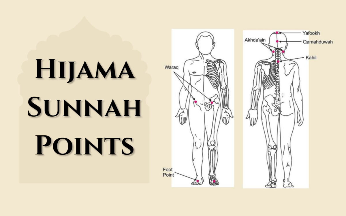 You are currently viewing Hijama Sunnah Points