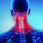Cupping (Hijama) for NECK PAIN
